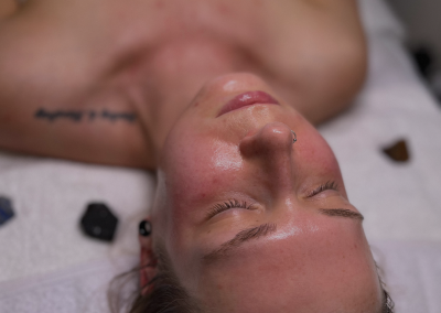 Post Facial Treatment woman with dewey glow