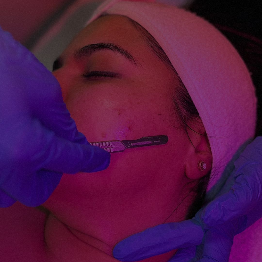 Dermaplaning facial