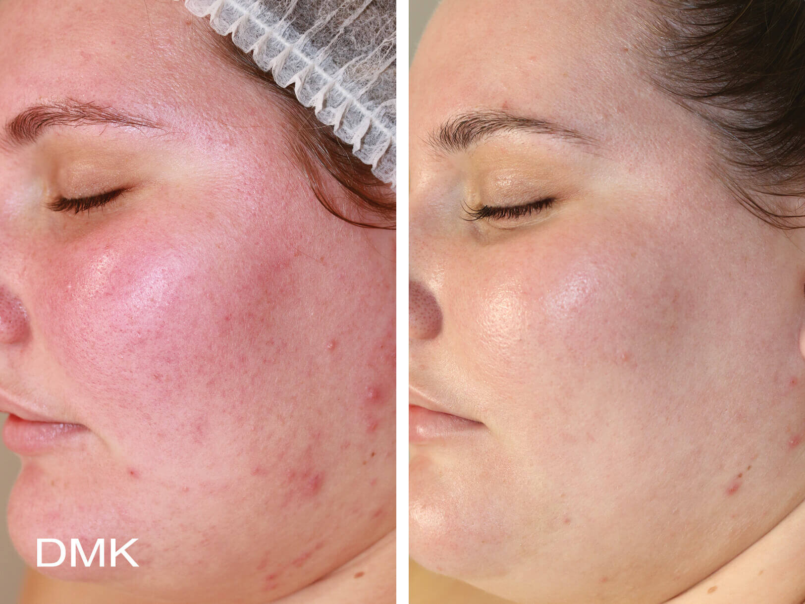 reactive_skin_3
