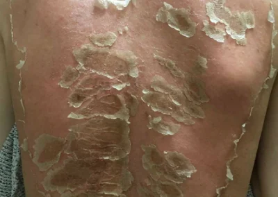 Zena Algae Peel For Body