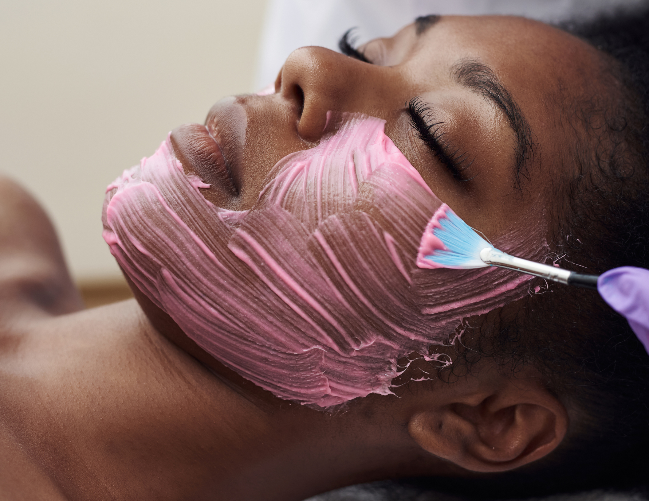 Chemical peel