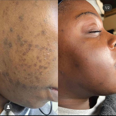 Zena Peel before and after