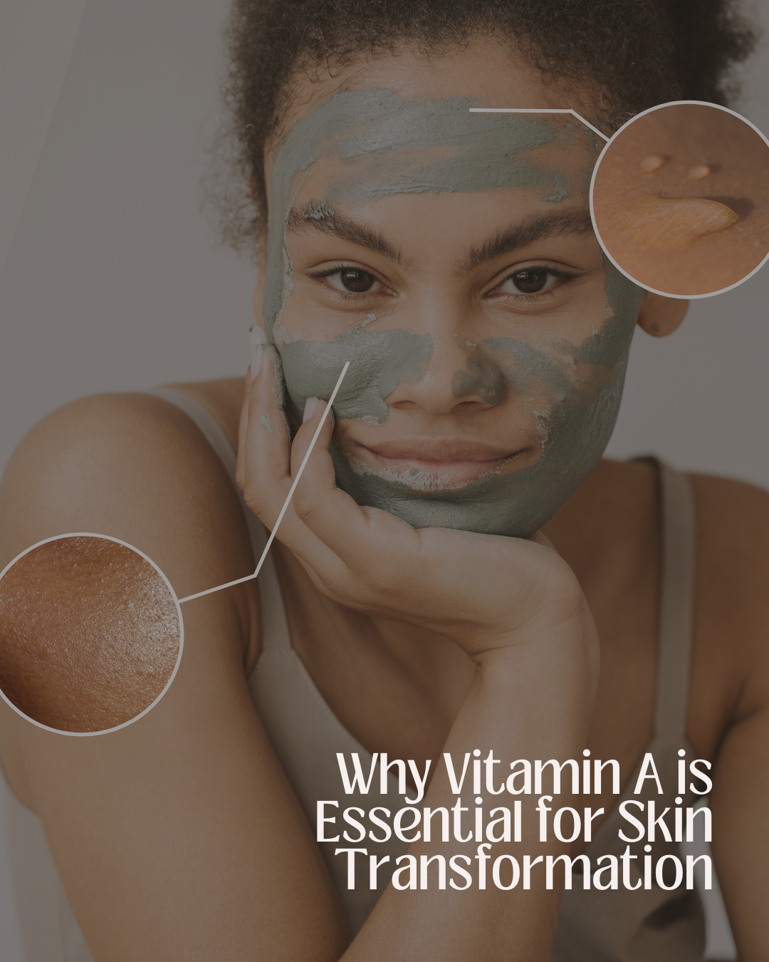 why Vit A is important for your skin?