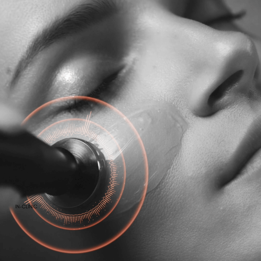 Environ Cool Peel with DF machine